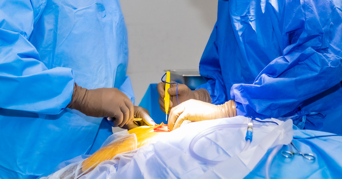 Veterinary Oncologic Surgery